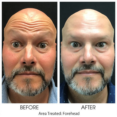 Before + After Gallery: Face