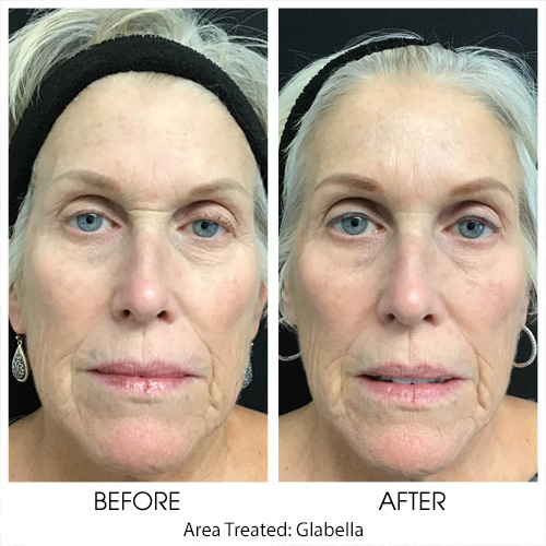 Before + After Gallery: Face