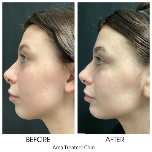 Before + After Gallery: Face