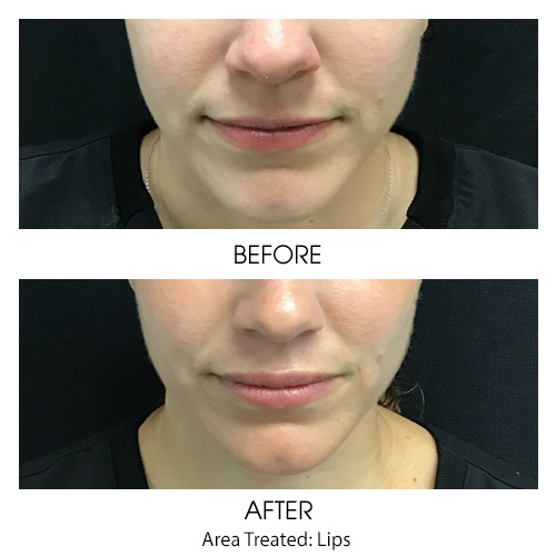 Before + After Gallery: Face