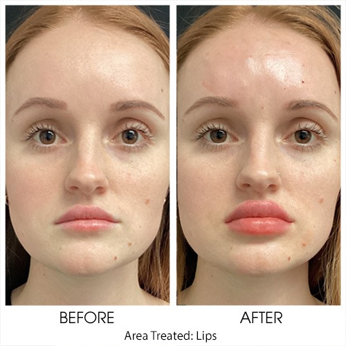 Before + After Gallery: Face