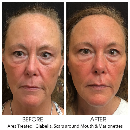 Before + After Gallery: Face