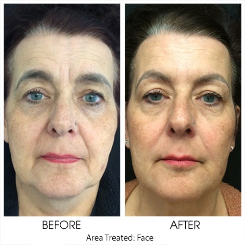 Before + After Gallery: Face