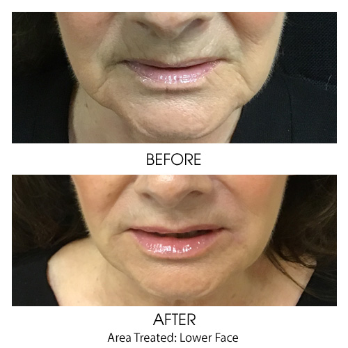 Before + After Gallery: Face