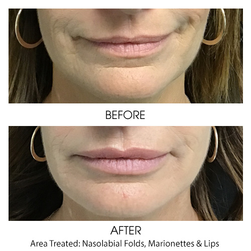 Before + After Gallery: Face