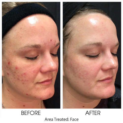 Before + After Gallery: Face