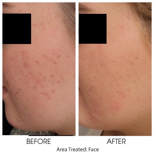 Before + After Gallery: Face