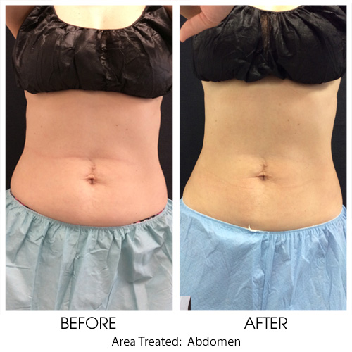 Before + After Gallery: Body
