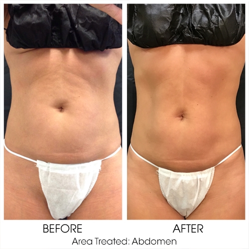 Before + After Gallery: Body