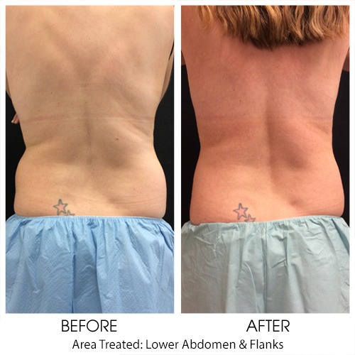 Before + After Gallery: Body