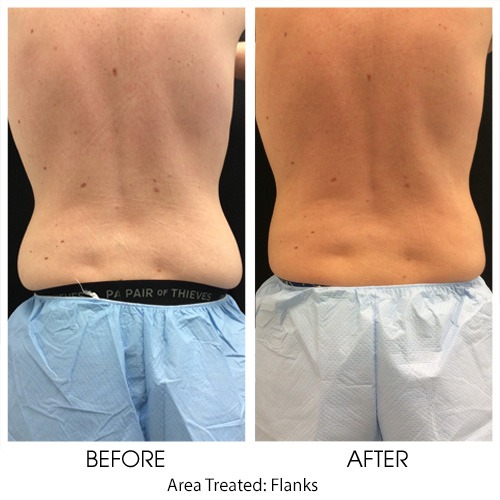 Before + After Gallery: Body