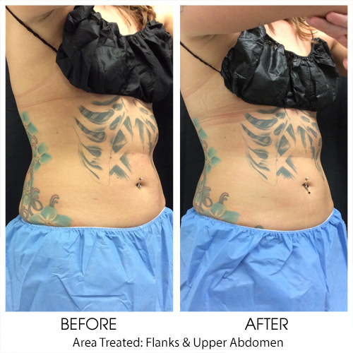 Before + After Gallery: Body