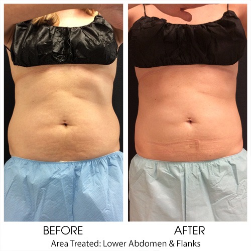 Before + After Gallery: Body