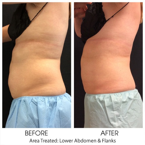 Before + After Gallery: Body