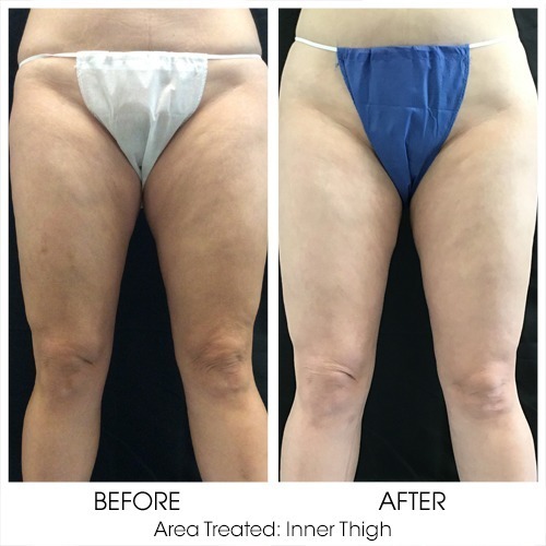 Before + After Gallery: Body