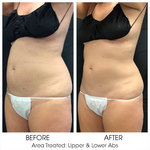 Before + After Gallery: Body