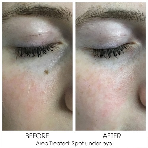 Before + After Gallery: Face