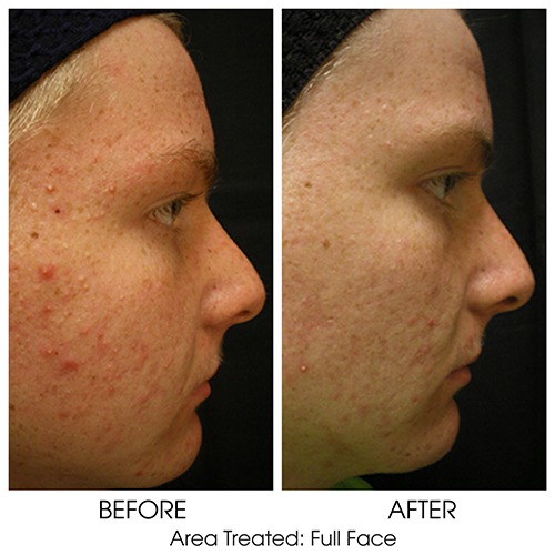 Before + After Gallery: Face