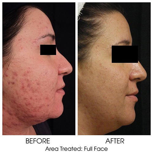 Before + After Gallery: Face