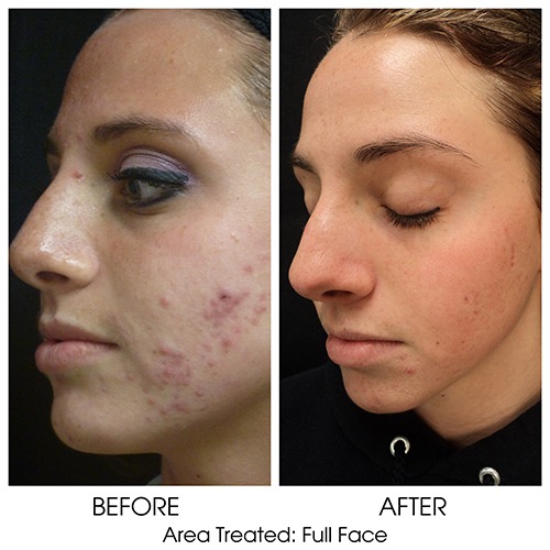 Before + After Gallery: Face