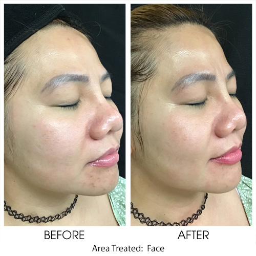 Before + After Gallery: Face