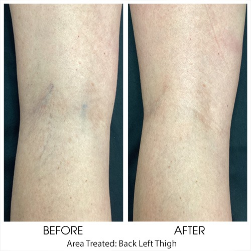 Before + After Gallery: Body