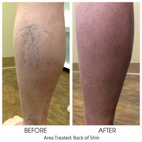 Before + After Gallery: Body