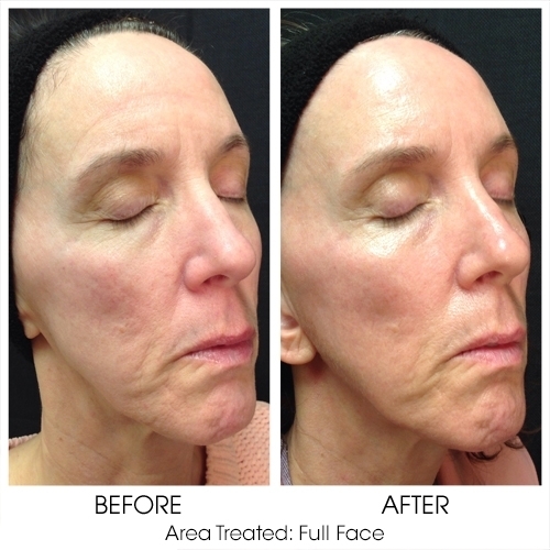 Before + After Gallery: Face