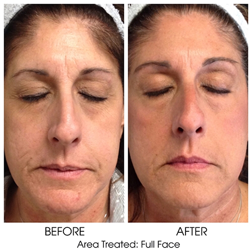 Before + After Gallery: Face