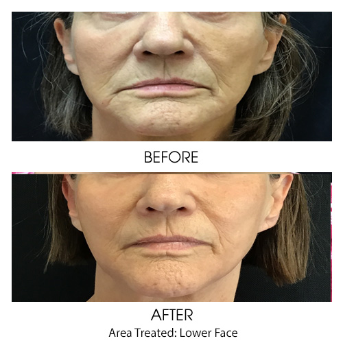 Before + After Gallery: Face
