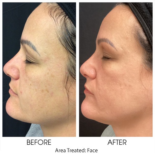 Before + After Gallery: Face