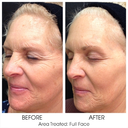 Before + After Gallery: Face