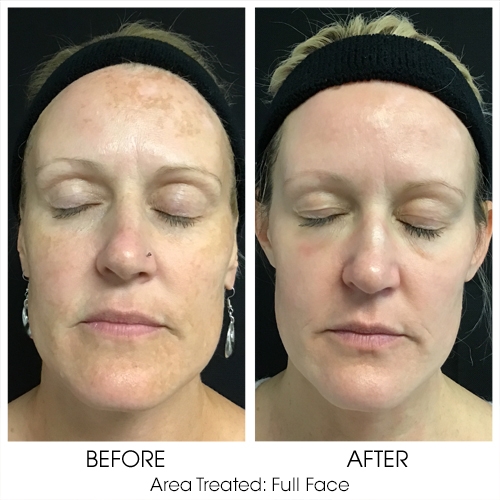 Before + After Gallery: Face