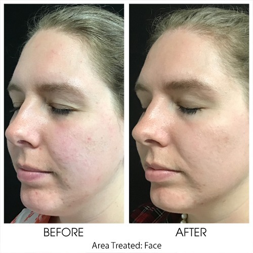 Before + After Gallery: Face