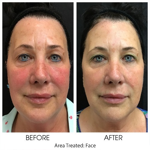 Before + After Gallery: Face