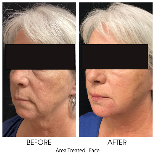 Before + After Gallery: Face