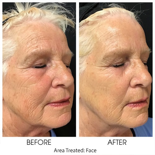 Before + After Gallery: Face