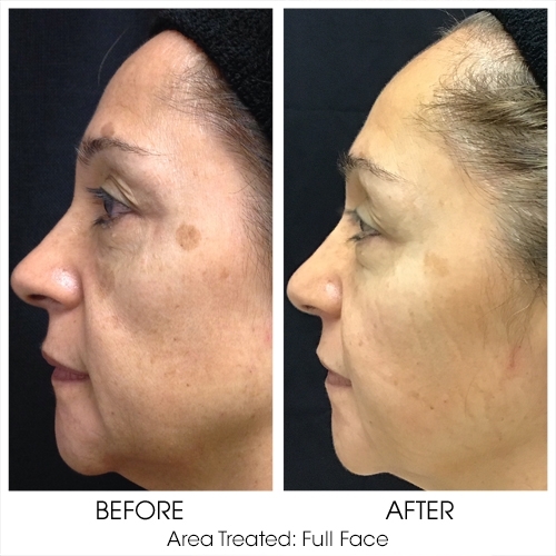 Before + After Gallery: Face